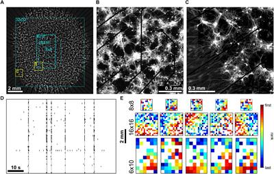 Inhomogeneities in Network Structure and Excitability Govern Initiation and Propagation of Spontaneous Burst Activity